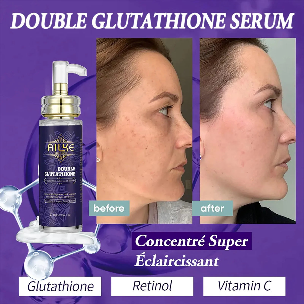 Ailke Double Glutathione Whitening Essence For Even Skin Tone