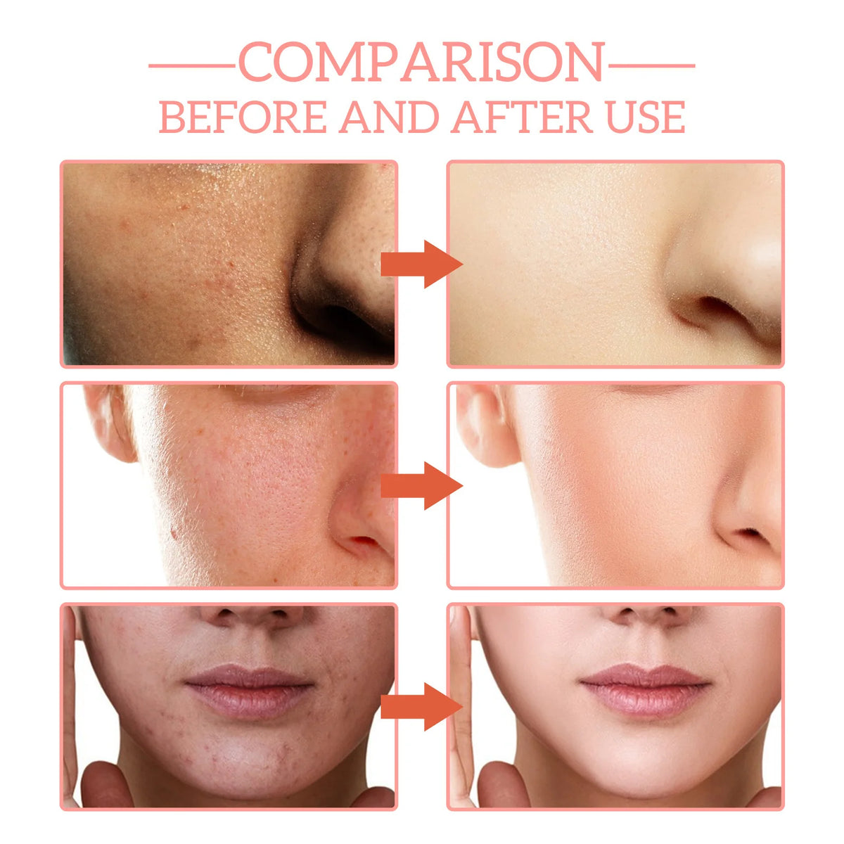 Jaysuing Anti Aging Face Serum For Fine Lines And Brightening